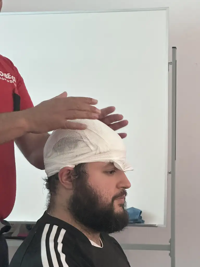 curativo na cabeça
